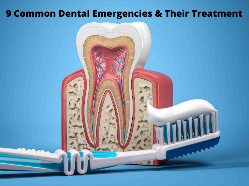 9 Common Dental Emergencies and Their Treatment