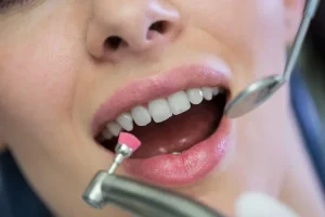 how to remove plaque from teeth