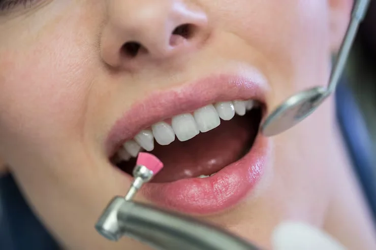 how to remove plaque from teeth