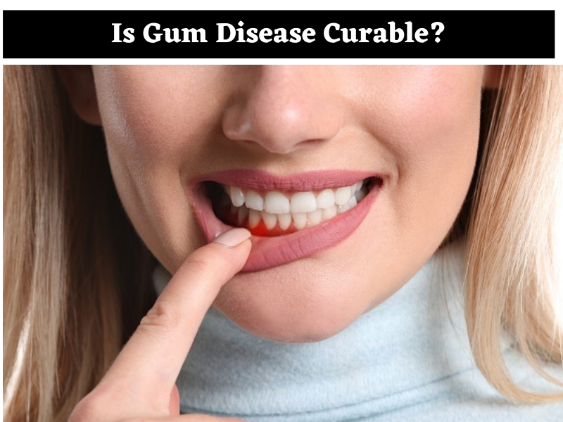 Is Gum Disease Curable
