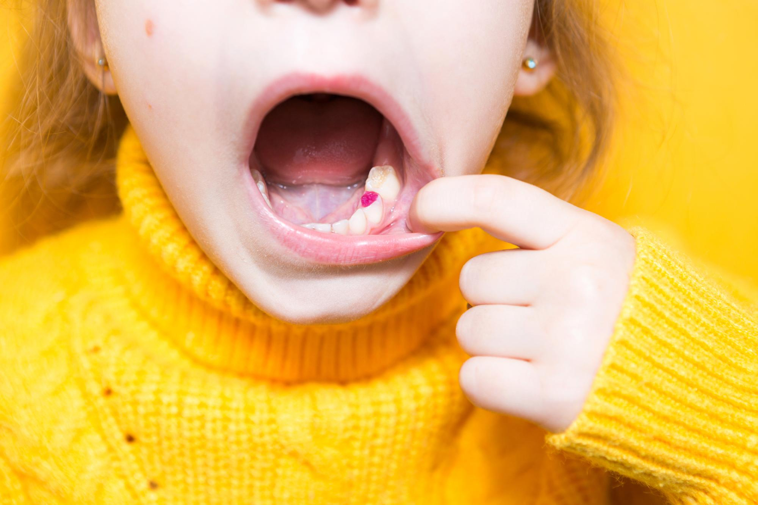 Understanding thumb sucking's impact on pediatric dental care - University Ave Dental
