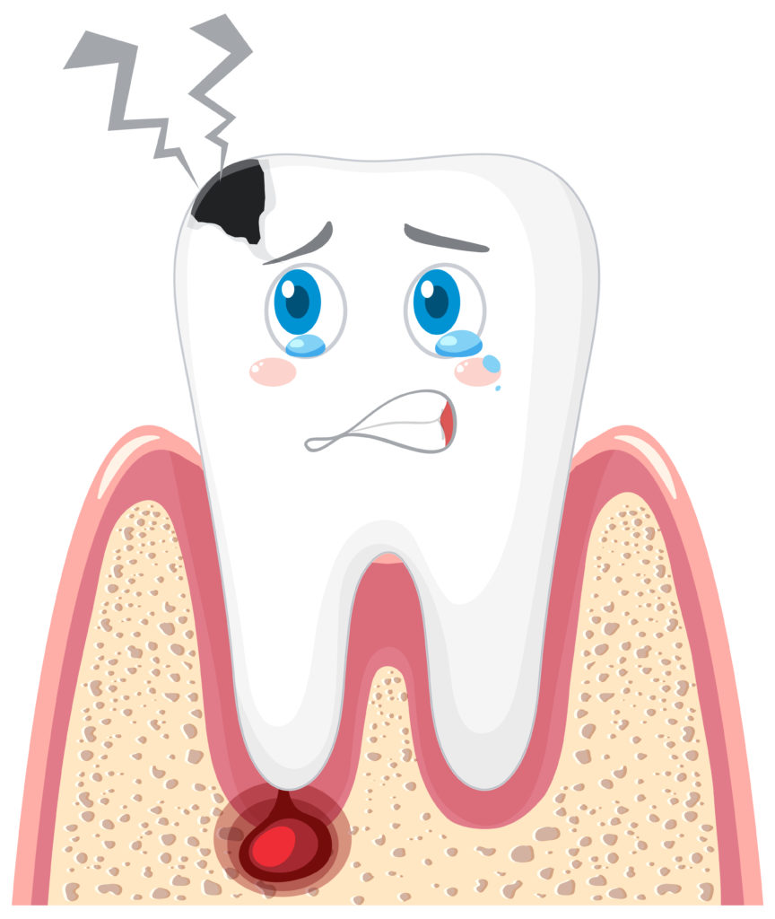 rct symptoms