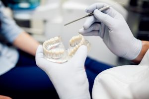 cerec crown
