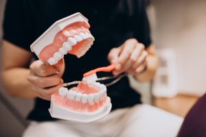 guide to dental bridges