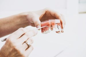 dental implants and bone loss patients