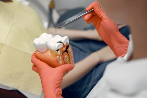how.much is a root canal