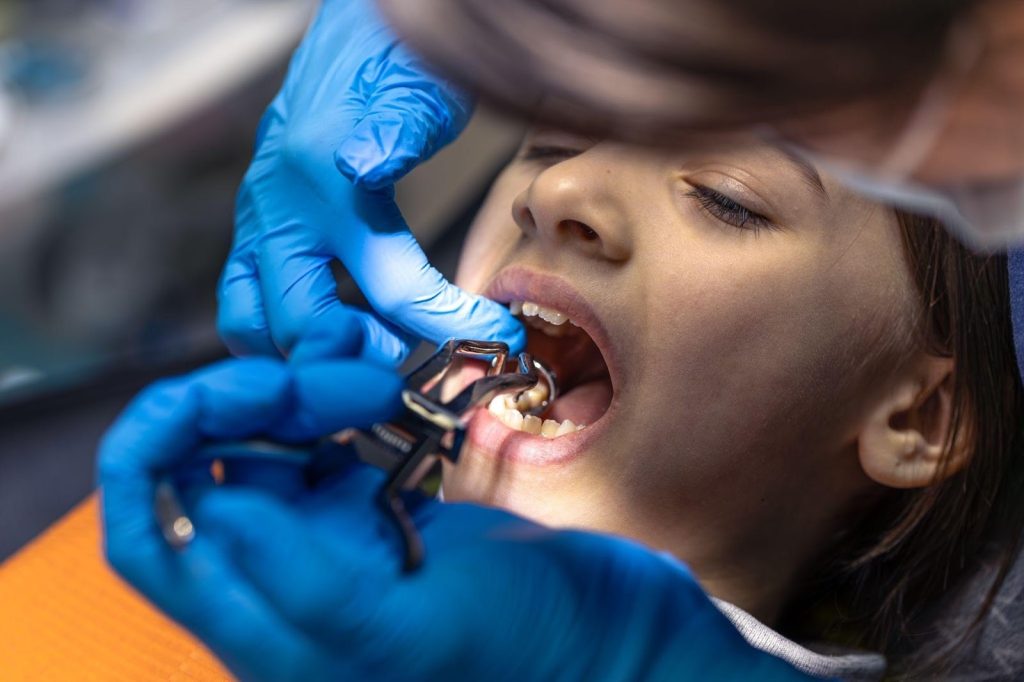 emergency extraction tooth​