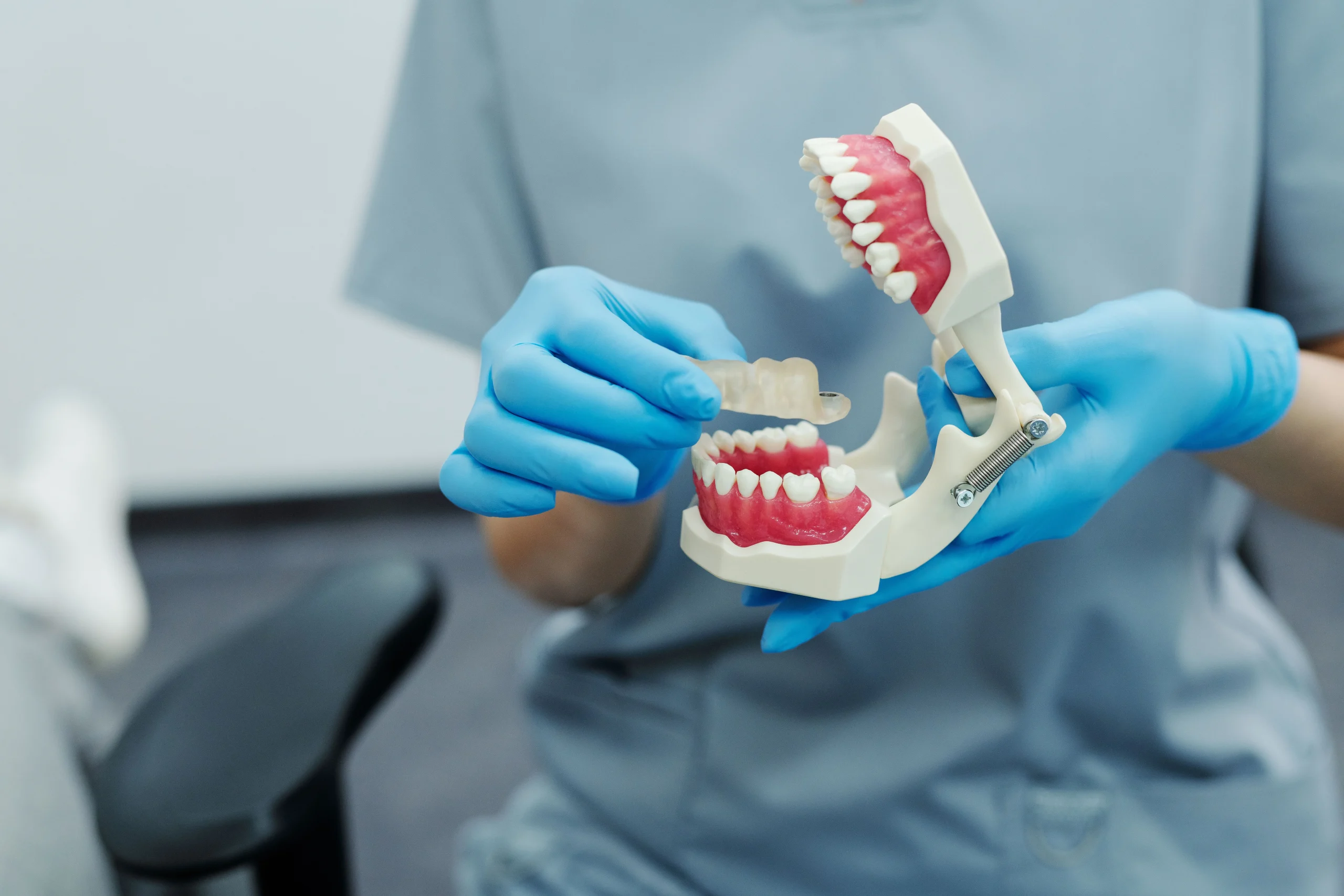 single tooth bridge