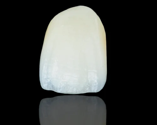 dental crowns